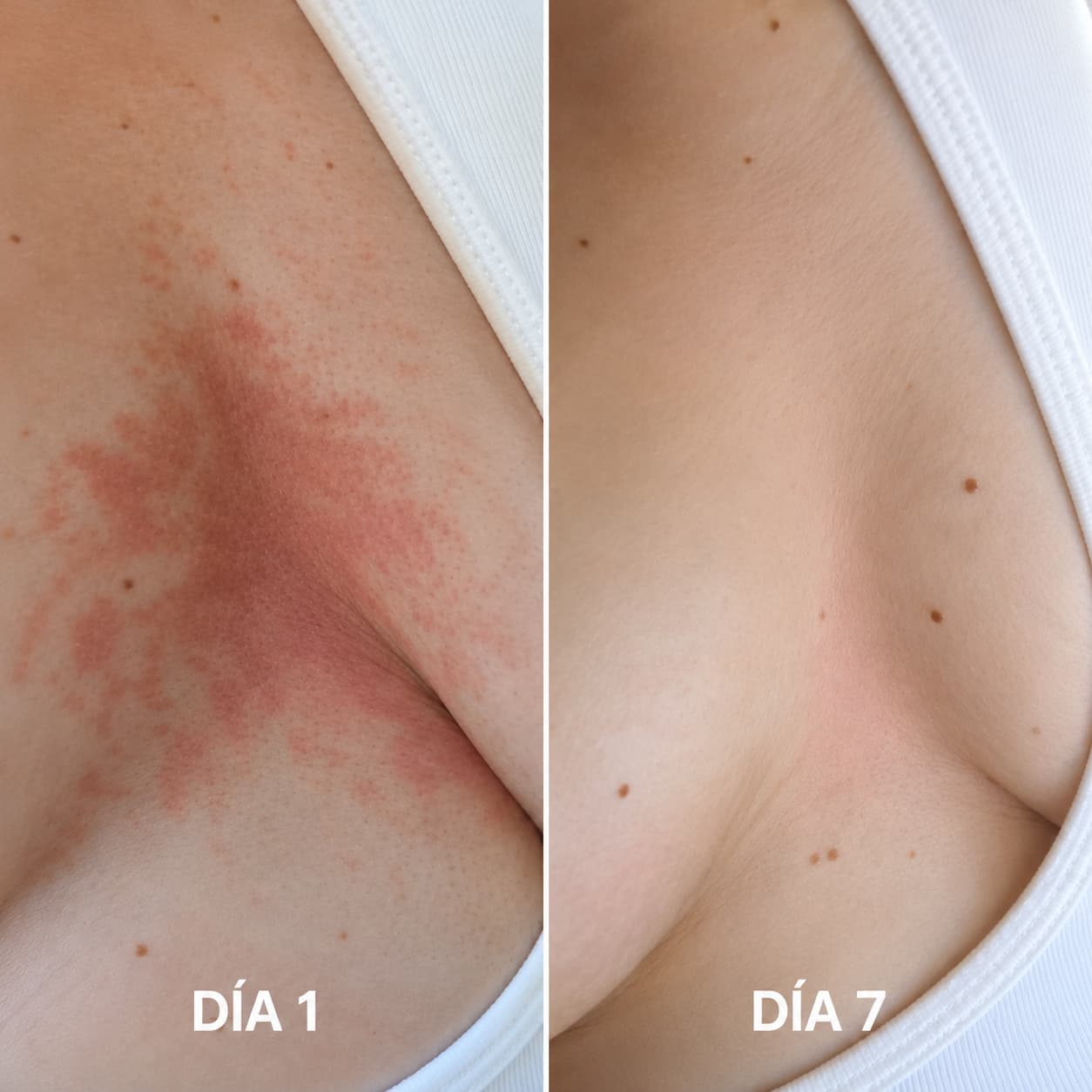 Blomera™ Jabón Natural para Picazón e Irritación